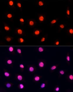 Invitrogen PRP19 Polyclonal Antibody 100 &mu;L; Unconjugated:Antibodies,