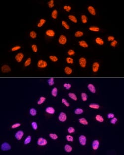 Invitrogen PRP19 Polyclonal Antibody 100 &mu;L; Unconjugated:Antibodies,