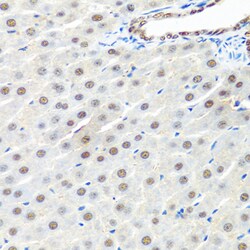 Invitrogen PRP19 Polyclonal Antibody 100 &mu;L; Unconjugated:Antibodies,