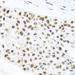 Invitrogen PRP19 Polyclonal Antibody 100 &mu;L; Unconjugated:Antibodies,