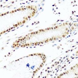 Invitrogen PRP19 Polyclonal Antibody 100 &mu;L; Unconjugated:Antibodies,