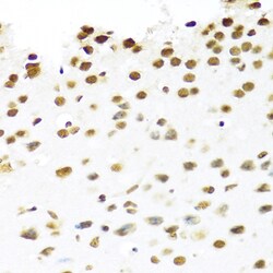 Invitrogen PRP19 Polyclonal Antibody 100 &mu;L; Unconjugated:Antibodies,