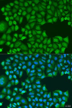 Invitrogen TIRAP Polyclonal Antibody 100 &mu;L; Unconjugated:Antibodies,