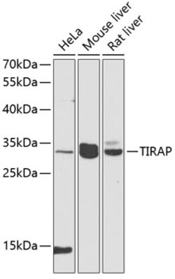 Invitrogen TIRAP Polyclonal Antibody 100 &mu;L; Unconjugated:Antibodies,