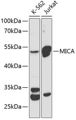 Invitrogen MICA Polyclonal Antibody 100 &mu;L; Unconjugated:Antibodies,