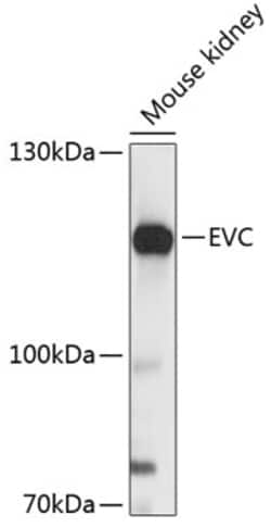 Invitrogen EVC Polyclonal Antibody 100 &mu;L; Unconjugated:Antibodies,