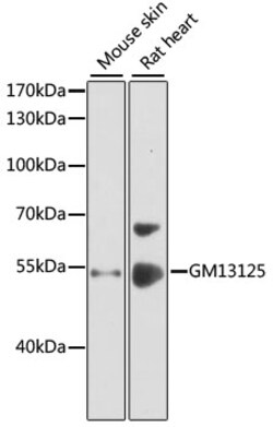 Invitrogen PRAMEF20 Polyclonal Antibody 100 &mu;L; Unconjugated:Antibodies,