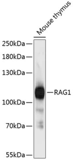 Invitrogen RAG1 Polyclonal Antibody 100 &mu;L; Unconjugated:Antibodies,