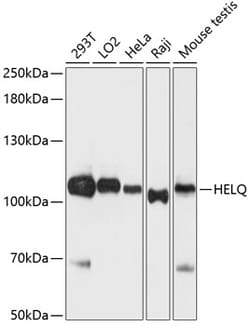 Invitrogen HELQ Polyclonal Antibody 100 &mu;L; Unconjugated:Antibodies,