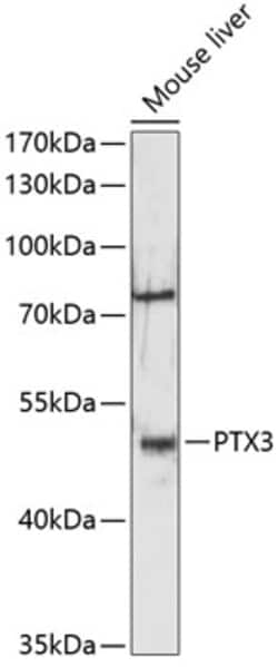 Invitrogen PTX3 Polyclonal Antibody 100 &mu;L | Buy Online | Invitrogen&trade; | Fisher Scientific