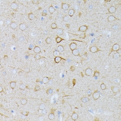 Invitrogen MEK1 Polyclonal Antibody 100 &mu;L; Unconjugated:Antibodies,