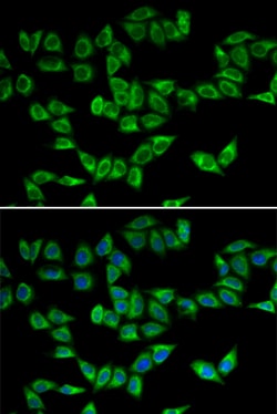 Invitrogen PRDX5 Polyclonal Antibody 100 &mu;L; Unconjugated:Antibodies,