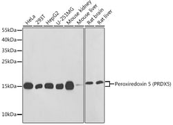 Invitrogen PRDX5 Polyclonal Antibody 100 &mu;L; Unconjugated:Antibodies,