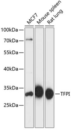 Invitrogen TFPI Polyclonal Antibody 100 &mu;L; Unconjugated:Antibodies,