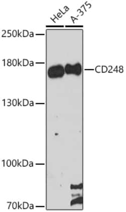 Invitrogen CD248 Polyclonal Antibody 100 &mu;L; Unconjugated:Antibodies,