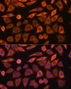 Invitrogen GUCY1A3 Polyclonal Antibody 100 &mu;L; Unconjugated:Antibodies,