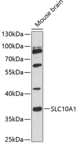 Invitrogen NTCP Polyclonal Antibody 100 &mu;L; Unconjugated:Antibodies,
