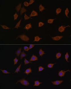 Invitrogen LSM1 Polyclonal Antibody 100 &mu;L; Unconjugated:Antibodies,