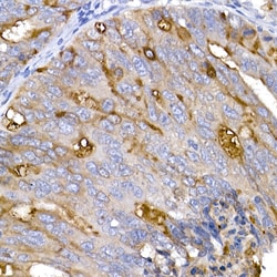 Invitrogen ACE2 Polyclonal Antibody 100 &mu;L; Unconjugated:Antibodies,