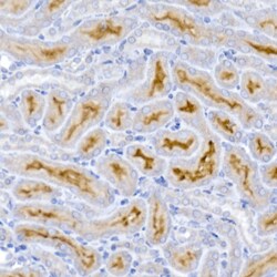 Invitrogen ACE2 Polyclonal Antibody 100 &mu;L; Unconjugated:Antibodies,