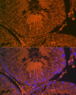Invitrogen ACE2 Polyclonal Antibody 100 &mu;L; Unconjugated:Antibodies,