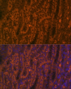 Invitrogen ACE2 Polyclonal Antibody 100 &mu;L; Unconjugated:Antibodies,