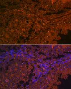 Invitrogen ACE2 Polyclonal Antibody 100 &mu;L; Unconjugated:Antibodies,
