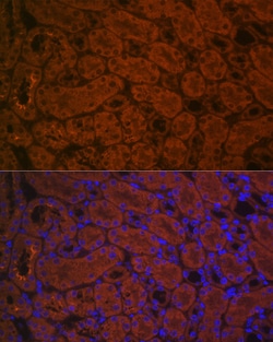 Invitrogen ACE2 Polyclonal Antibody 100 &mu;L; Unconjugated:Antibodies,