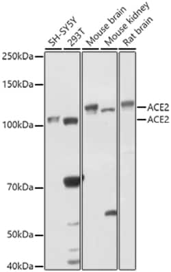 Invitrogen ACE2 Polyclonal Antibody 100 &mu;L; Unconjugated:Antibodies,