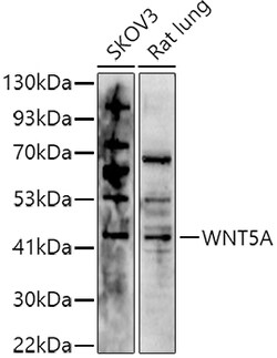 Invitrogen WNT5A Polyclonal Antibody 100 &mu;L | Buy Online | Invitrogen&trade; | Fisher Scientific