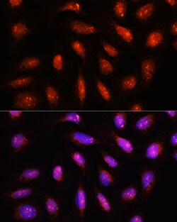 Invitrogen COPS8 Polyclonal Antibody 100 &mu;L; Unconjugated:Antibodies,