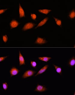 Invitrogen COPS8 Polyclonal Antibody 100 &mu;L; Unconjugated:Antibodies,