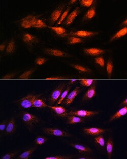 Invitrogen COPS8 Polyclonal Antibody 100 &mu;L; Unconjugated:Antibodies,