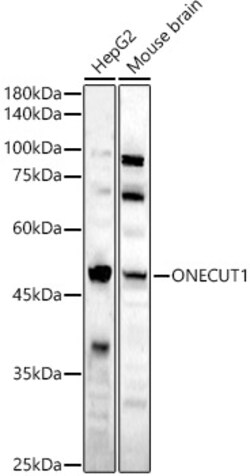 Invitrogen HNF6 Polyclonal Antibody 100 &mu;L; Unconjugated:Antibodies,