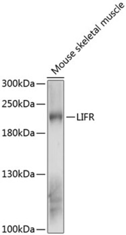 Invitrogen LIFR Polyclonal Antibody 100 &mu;L; Unconjugated:Antibodies,
