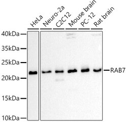 Invitrogen RAB7A Polyclonal Antibody 100 &mu;L | Buy Online | Invitrogen&trade; | Fisher Scientific