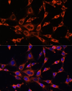 Invitrogen ITPR3 Polyclonal Antibody 100 &mu;L; Unconjugated:Antibodies,