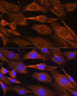Invitrogen PHOSPHO2 Polyclonal Antibody 100 &mu;L; Unconjugated:Antibodies,