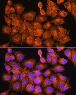 Invitrogen PHOSPHO2 Polyclonal Antibody 100 &mu;L; Unconjugated:Antibodies,