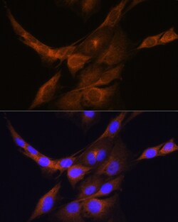 Invitrogen PHOSPHO2 Polyclonal Antibody 100 &mu;L; Unconjugated:Antibodies,
