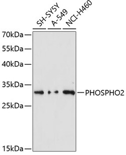 Invitrogen PHOSPHO2 Polyclonal Antibody 100 &mu;L; Unconjugated:Antibodies,