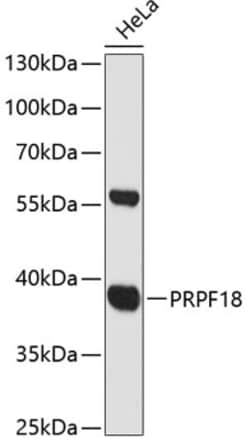 Invitrogen PRPF18 Polyclonal Antibody 100 &mu;L; Unconjugated:Antibodies,