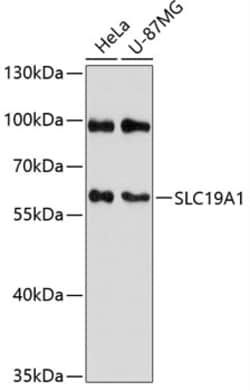 Invitrogen SLC19A1 Polyclonal Antibody 100 &mu;L; Unconjugated:Antibodies,