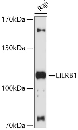 Invitrogen CD85j (ILT2) Polyclonal Antibody 100 &mu;L; Unconjugated:Antibodies,