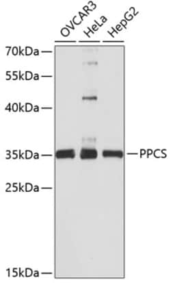Invitrogen PPCS Polyclonal Antibody 100 &mu;L; Unconjugated:Antibodies,