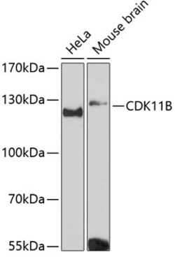 Invitrogen CDK11B Polyclonal Antibody 100 &mu;L | Buy Online | Invitrogen&trade; | Fisher Scientific