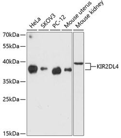 KIR2DL4 Polyclonal Antibody, Invitrogen 100 &mu;L; Unconjugated:Antibodies,