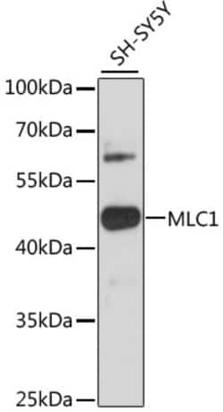 Invitrogen MLC1 Polyclonal Antibody 100 &mu;L; Unconjugated:Antibodies,