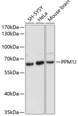 Invitrogen PPM1J Polyclonal Antibody 100 &mu;L; Unconjugated:Antibodies,