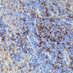 Invitrogen HLA-B Polyclonal Antibody 100 &mu;L; Unconjugated:Antibodies,
